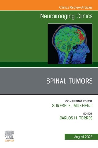 Cover image: Spinal Tumors, An Issue of Neuroimaging Clinics of North America 1st edition 9780323938679