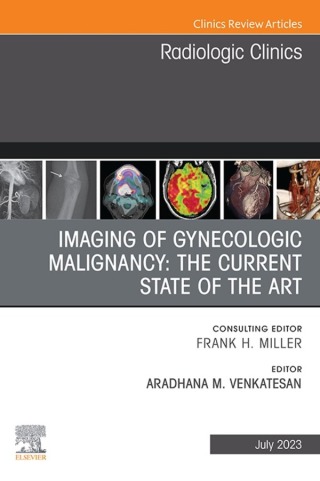 表紙画像: Imaging of Gynecologic Malignancy: The Current State of the Art, An Issue of Radiologic Clinics of North America 1st edition 9780323940351