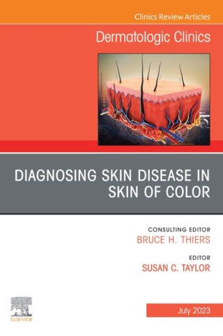 Cover image: Diagnosing Skin Disease in Skin of Color, An Issue of Dermatologic Clinics 1st edition 9780323940375