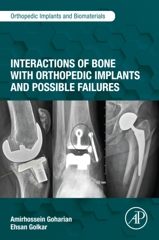 Imagen de portada: Interactions of Bone with Orthopedic Implants and Possible Failures 9780323954105