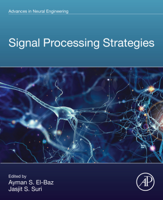 Imagen de portada: Signal Processing Strategies 9780323954372