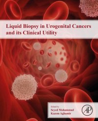 Titelbild: Liquid Biopsy in Urogenital Cancers and its Clinical Utility 9780323998840