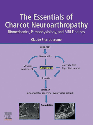 Titelbild: The Essentials of Charcot Neuroarthropathy 9780323993524