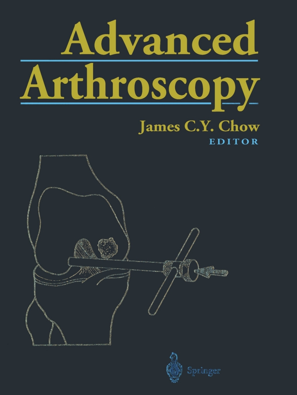 Advanced Arthroscopy 1st Edition