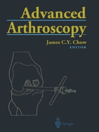 صورة الغلاف: Advanced Arthroscopy 1st edition 9780387988085