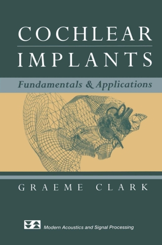 Cover image: Cochlear Implants 9780387955834