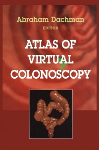 Cover image: Atlas of Virtual Colonoscopy 1st edition 9780387955117