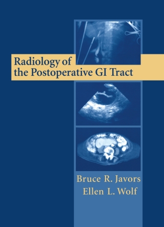 Imagen de portada: Radiology of the Postoperative GI Tract 9780387952000