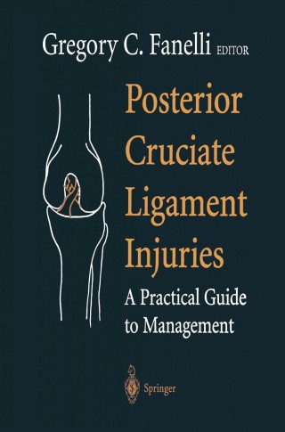 Cover image: Posterior Cruciate Ligament Injuries 1st edition 9780387985732