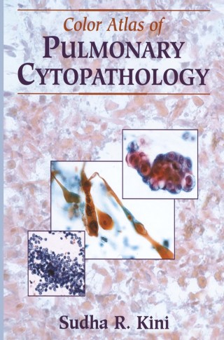表紙画像: Color Atlas of Pulmonary Cytopathology 9781441929778