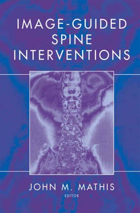 Image-Guided Spine Interventions, 1st Edition - FULL INSTANT DOWNLOAD | PDF DOCX EPUB