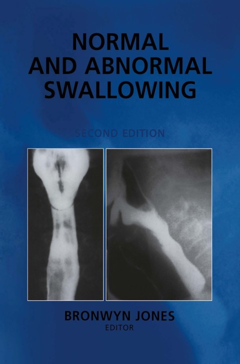 Normal and Abnormal Swallowing: Imaging in Diagnosis and Therapy, 2nd Edition - FULL INSTANT DOWNLOAD | PDF DOCX EPUB