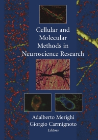 Imagen de portada: Cellular and Molecular Methods in Neuroscience Research 1st edition 9780387953861