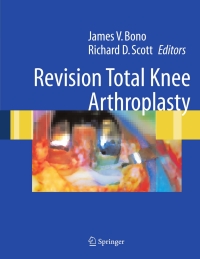 Cover image: Revision Total Knee Arthroplasty 1st edition 9780387223520