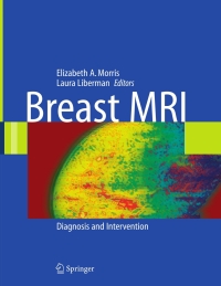 Imagen de portada: Breast MRI 1st edition 9780387219974