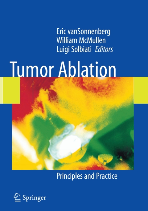 Tumor Ablation: Principles and Practice - FULL INSTANT DOWNLOAD | PDF DOCX EPUB