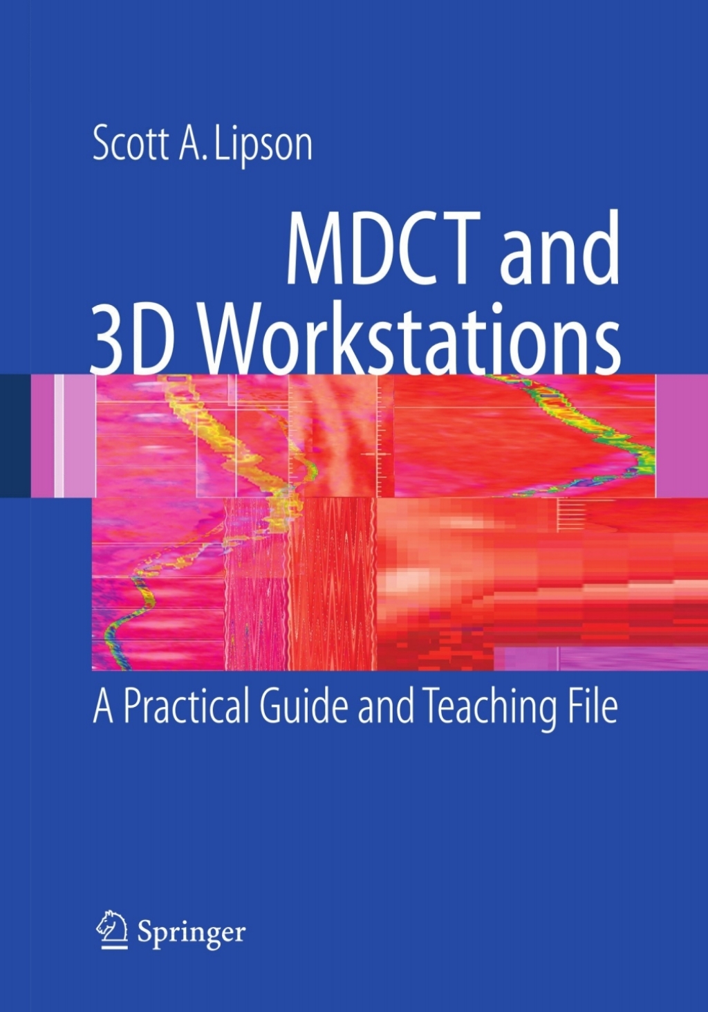 MDCT and 3D Workstations eBook Rental