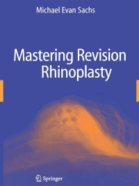 Cover image: Mastering Revision Rhinoplasty 9780387989044