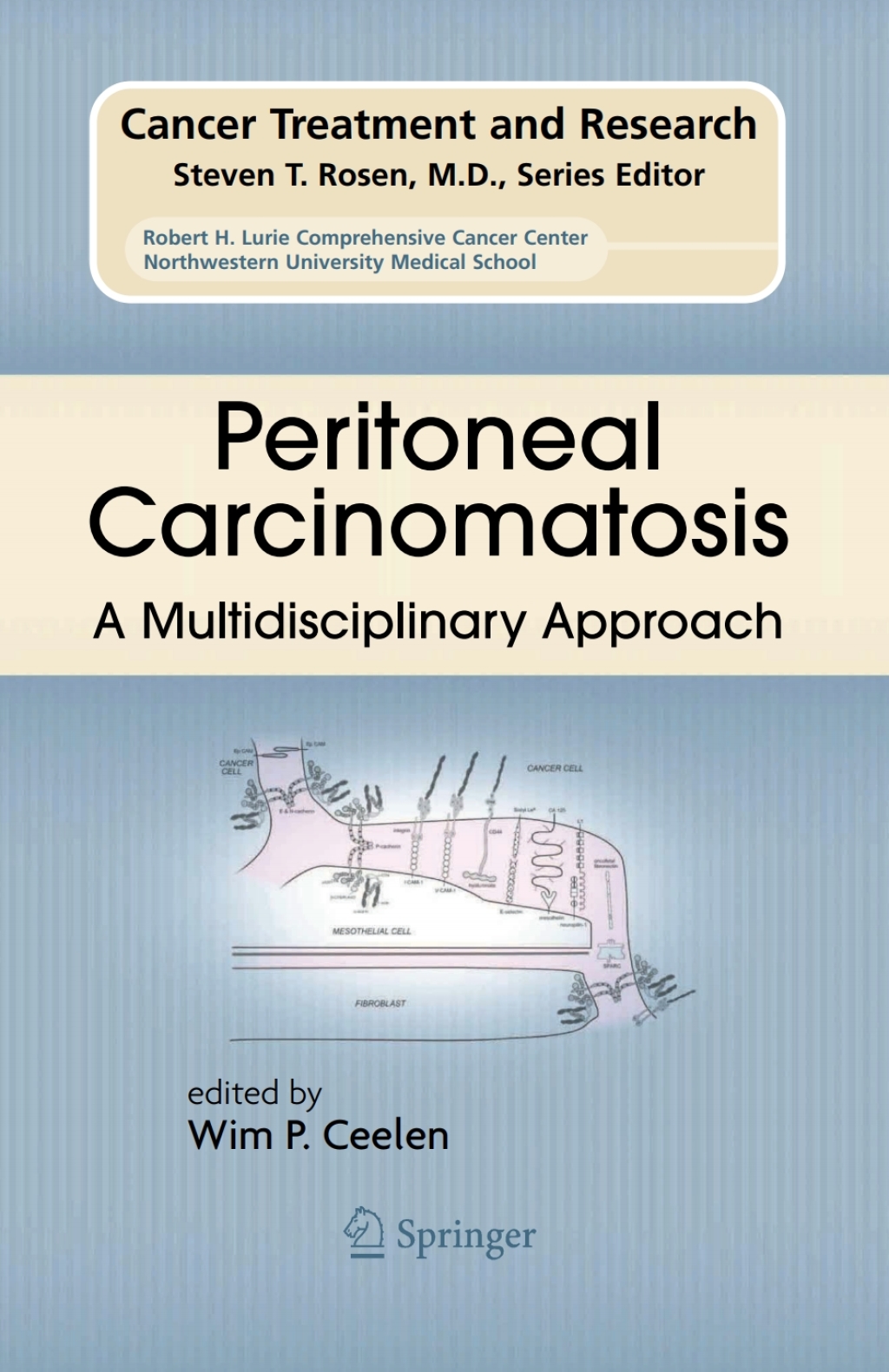 Peritoneal Carcinomatosis: A Multidisciplinary Approach 1st Edition