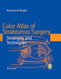 Cover image: Color Atlas of Strabismus Surgery 3rd edition 9780387332499