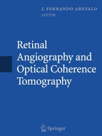 Titelbild: Retinal Angiography and Optical Coherence Tomography 1st edition 9780387689869