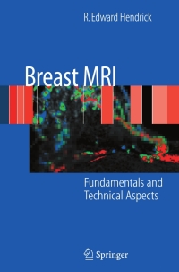 Cover image: Breast MRI 9780387735061