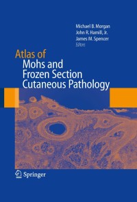 صورة الغلاف: Atlas of Mohs and Frozen Section Cutaneous Pathology 1st edition 9780387847993