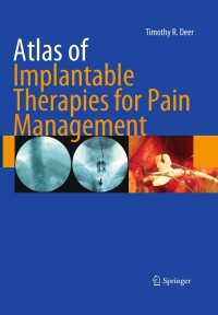 Cover image: Atlas of Implantable Therapies for Pain Management 9780387885667