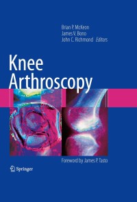 Cover image: Knee Arthroscopy 1st edition 9780387895031