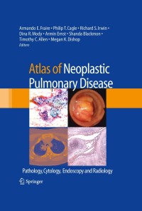 صورة الغلاف: Atlas of Neoplastic Pulmonary Disease 1st edition 9780387898384