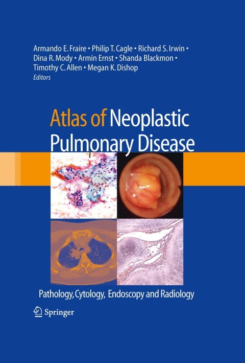 Atlas of Neoplastic Pulmonary Disease: Pathology, Cytology, Endoscopy and Radiology, 1st Edition - FULL INSTANT DOWNLOAD | PDF DOCX EPUB
