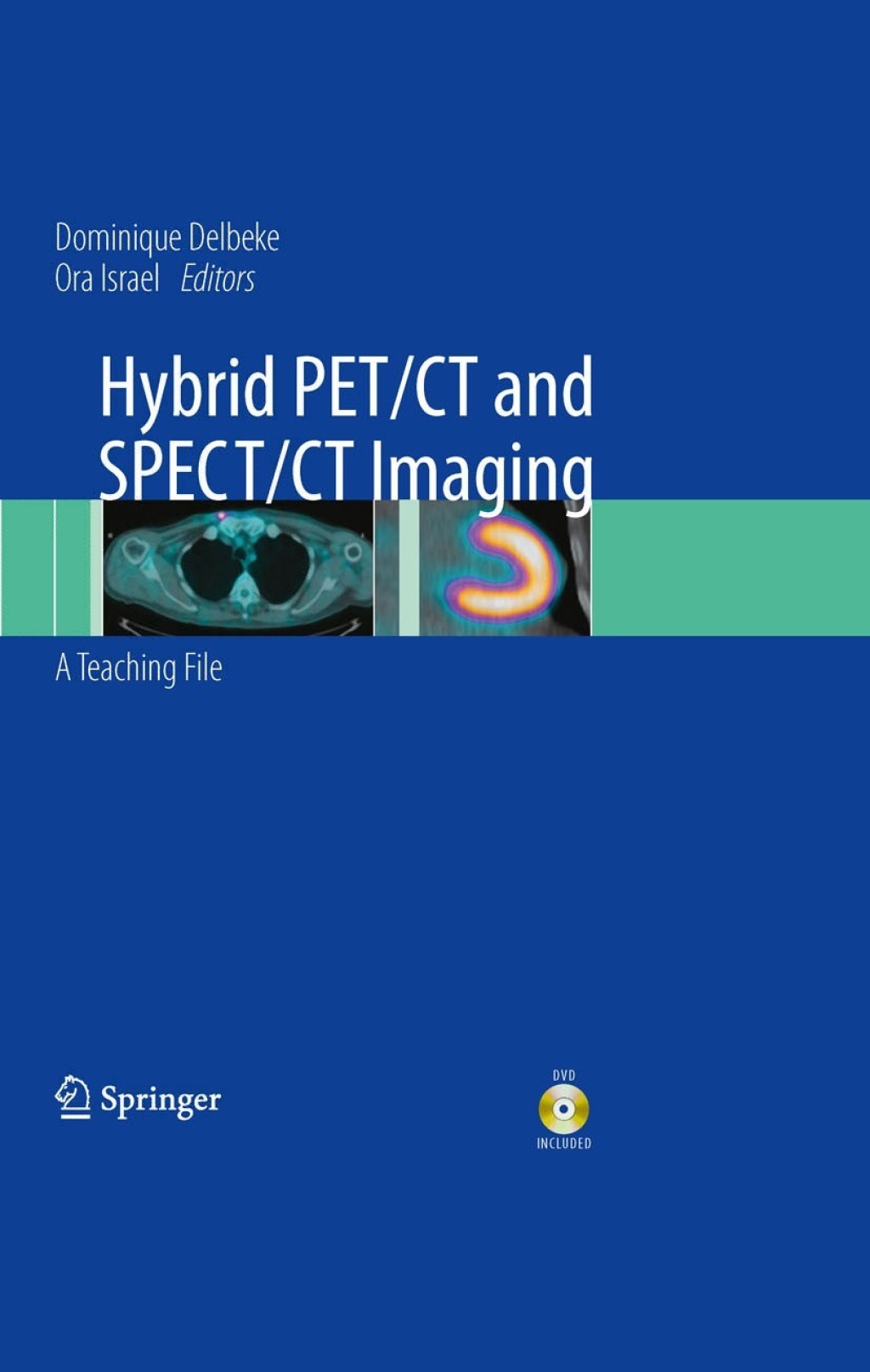 Hybrid PET/CT and SPECT/CT Imaging A Teaching File 1st Edition