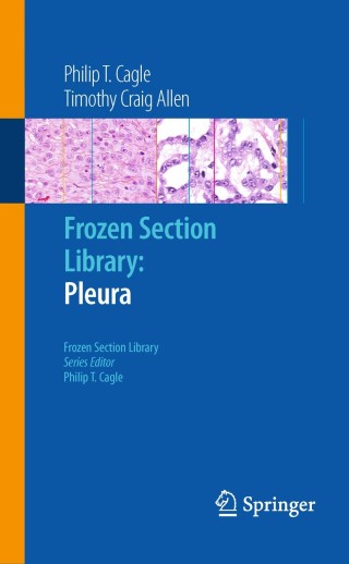 Immagine di copertina: Frozen Section Library: Pleura 9780387959856