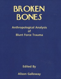 Cover image: Broken Bones: Anthropological Analysis of Blunt Force Trauma 1st edition 9780398069926