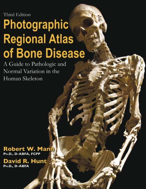 Photographic Regional Atlas of Bone Disease: "A Guide to Pathologic and Normal Variationin the Human Skeleton", 3rd Edition - FULL INSTANT DOWNLOAD | PDF DOCX EPUB