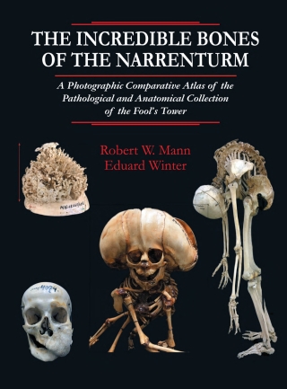 Omslagafbeelding: The Incredible Bones of the Narrenturm: A Photographic Comparative Atlas of the Pathological and Anatomical Collection of the Fool's Tower 1st edition 9780398094102
