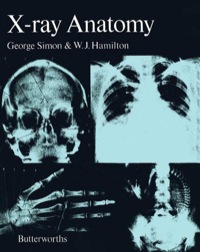 Titelbild: X-Ray Anatomy 9780407000964