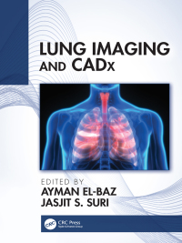 Cover image: Lung Imaging and CADx 1st edition 9781138050914