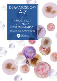 Cover image: Dermatoscopy A-Z 1st edition 9780367197810