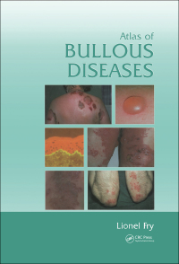 Cover image: Atlas of Bullous Diseases 1st edition 9780415383387