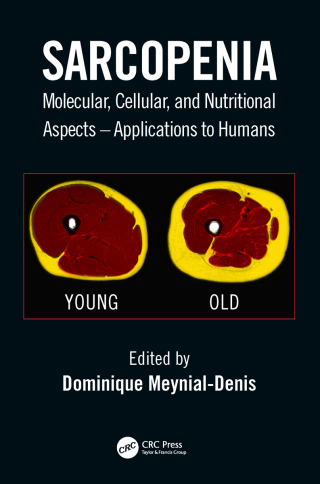 Cover image: Sarcopenia 1st edition 9781498765138