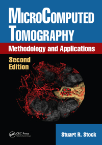 Immagine di copertina: MicroComputed Tomography 2nd edition 9781032337388