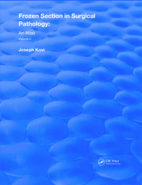 Imagen de portada: Frozen Section In Surgical Pathology 1st edition 9780367208073