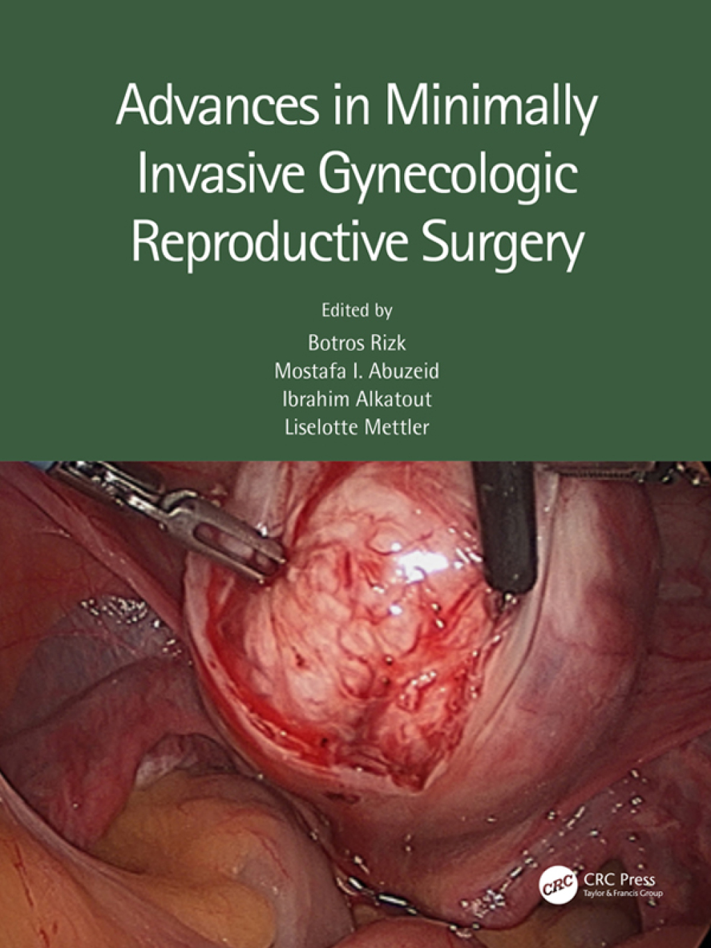 Advances in Minimally Invasive Gynecologic Reproductive Surgery 1st Edition