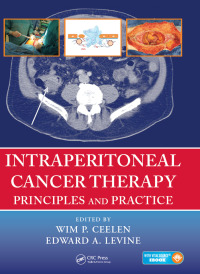 Cover image: Intraperitoneal Cancer Therapy 1st edition 9780367575250