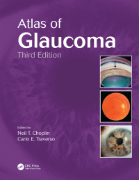 Cover image: Atlas of Glaucoma 3rd edition 9781482209211