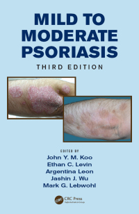 Cover image: Mild to Moderate Psoriasis 3rd edition 9781482215083