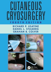 Cover image: Cutaneous Cryosurgery 4th edition 9781482214734