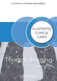 Omslagafbeelding: Thoracic Imaging 2nd edition 9781138409927
