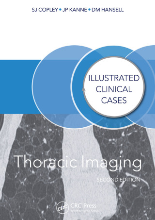 Imagen de portada: Thoracic Imaging 2nd edition 9781138409927